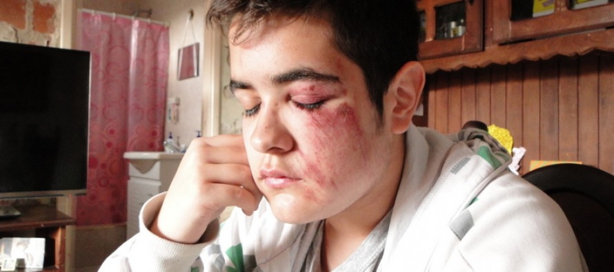 Agredieron a un joven de 15 años al resistirse a un robo en Brandsen y 9 de Julio a plena luz del día