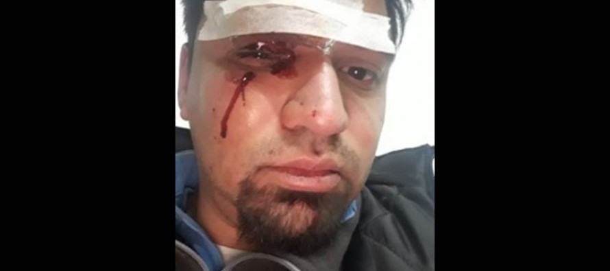 Salvaje agresión en Virreyes a un chofer de la línea 203